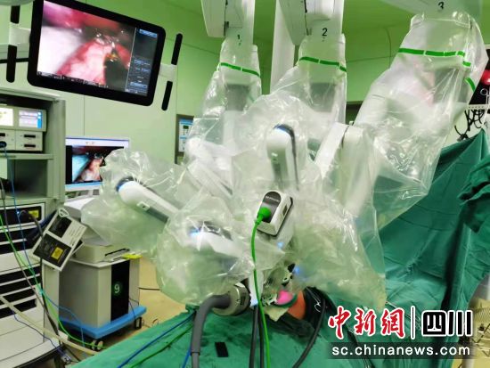 圖為達芬奇手術機器人。成都市婦女兒童中心醫院供圖 圖為達芬奇手術機器人。成都市婦女兒童中心醫院供圖