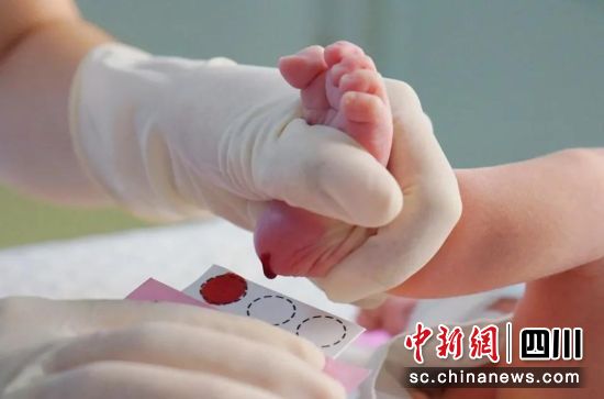 新生兒取足跟血接受篩查。成都市婦女兒童中心醫院供圖 新生兒取足跟血接受篩查。成都市婦女兒童中心醫院供圖